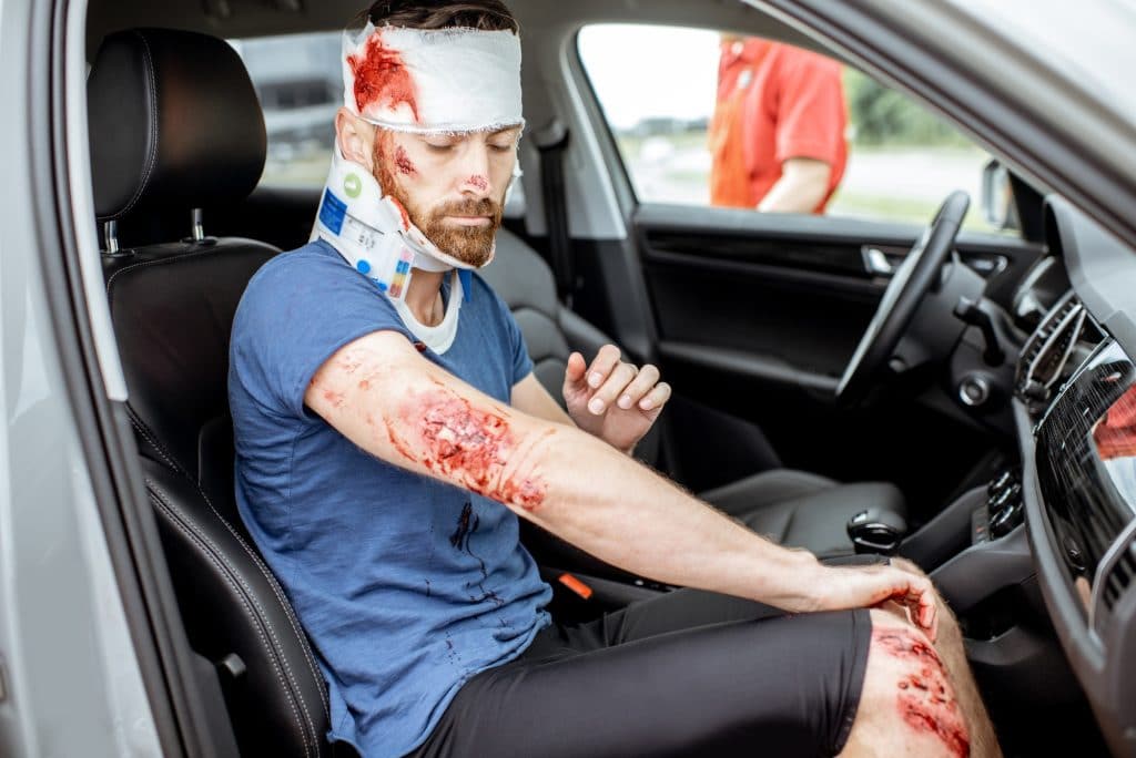 Car Accident Injury Attorney Lawrenceville